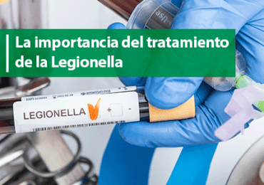 La importancia del tratamiento de la Legionella